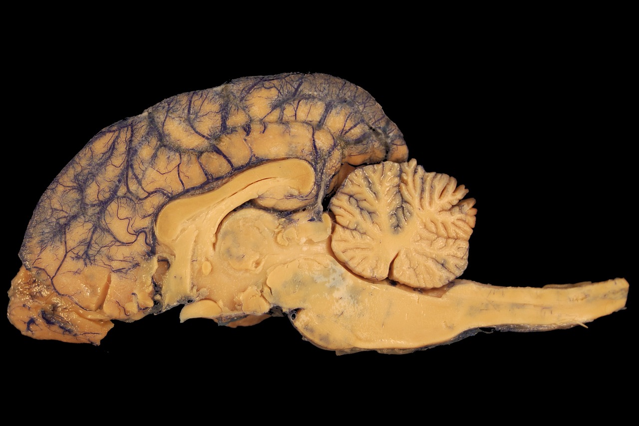 How Does the Brain Achieve Consciousness?